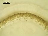 5 – Sezione trasversale di un articolo con cellule corticali sovrastate da una guaina mucillaginosa